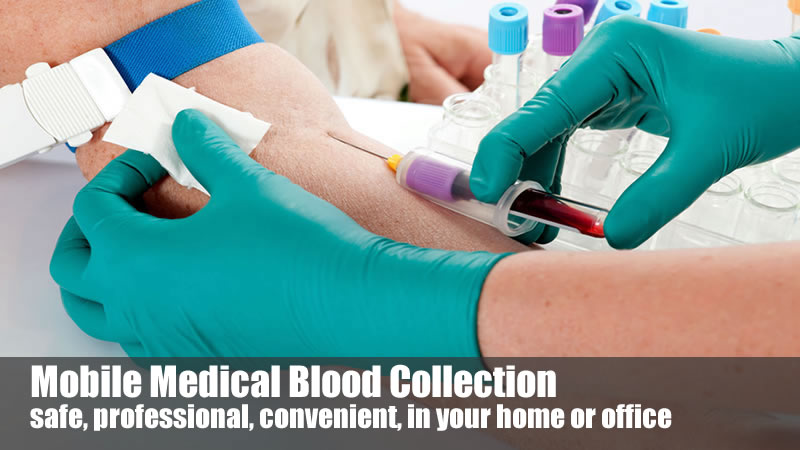 Blood Sample Collection-Phlebotomy Blood Draw - Company